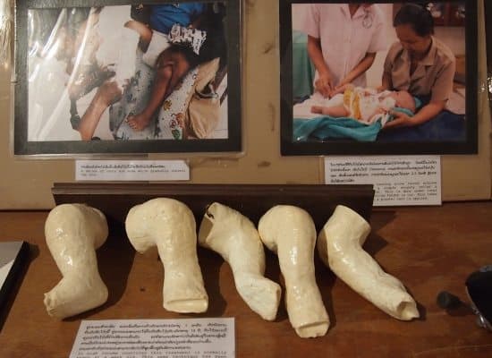 Cope Vientiane Laos